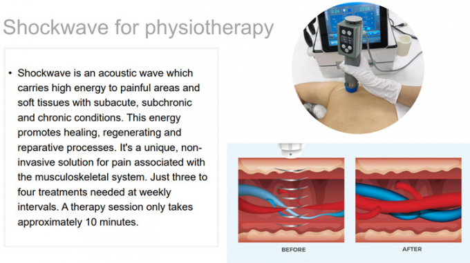 Equipo de la terapia de la terapia física/de la onda expansiva extracorporal/alivio del dolor tecar de la terapia de la terapia de la onda de choque